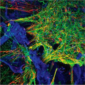 Die Neuronen leuchten dank Fluoreszenzmarkern grün.