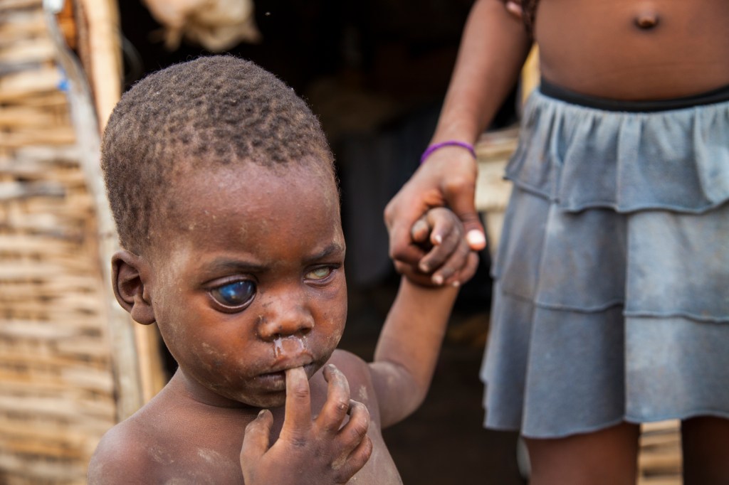 A child in a camp on the Haiti–Dominican Republic border.