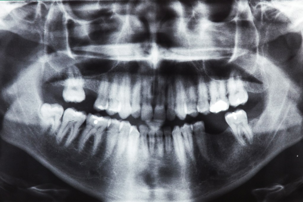 A 360-degree dental x-ray.