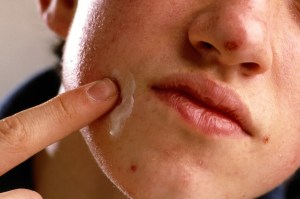 jongen smeert acne creme op gezicht