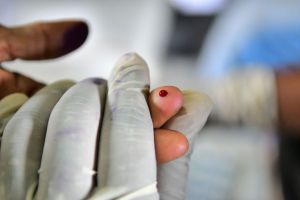 hand met een rubberen handschoen om die een geprikte vinger vasthoudt