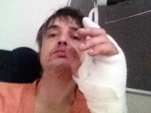 Pete Doherty Hedgehog Injury Hosptial