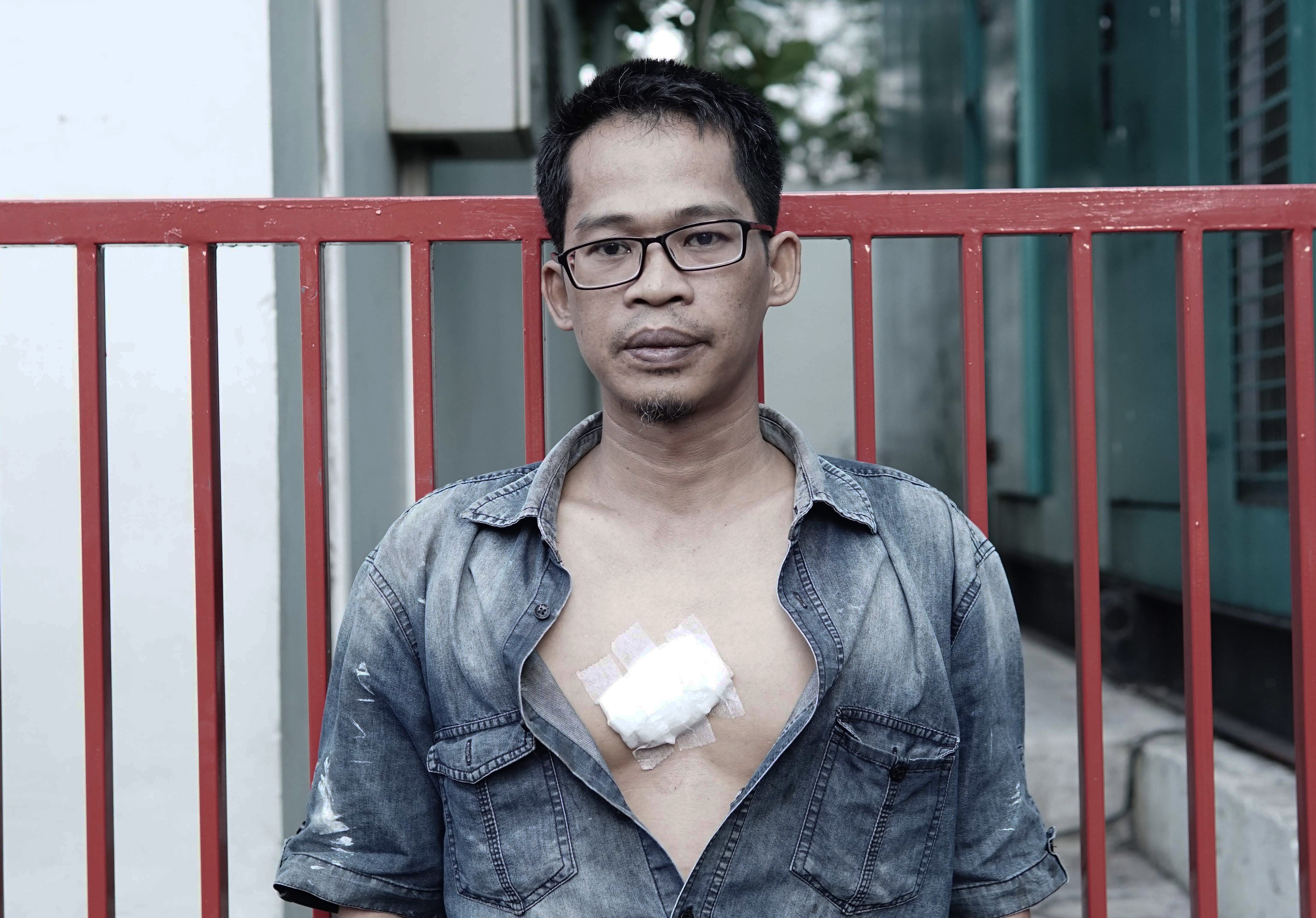 A man shot with a rubber bullet in the Jakarta election riots.