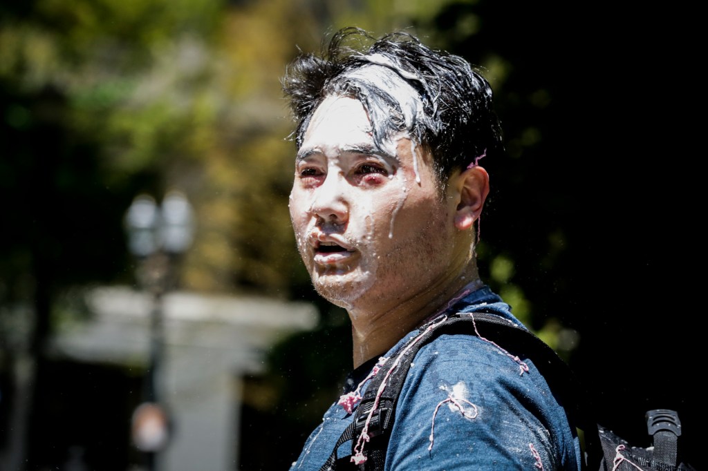 Andy Ngo, a Portland-based journalist, is seen covered in unknown substance after unidentified Rose City Antifa members attacked him on June 29, 2019 in Portland, Oregon. (Photo by Moriah Ratner/Getty Images)​​