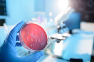 Petri dish being held by a scientist.