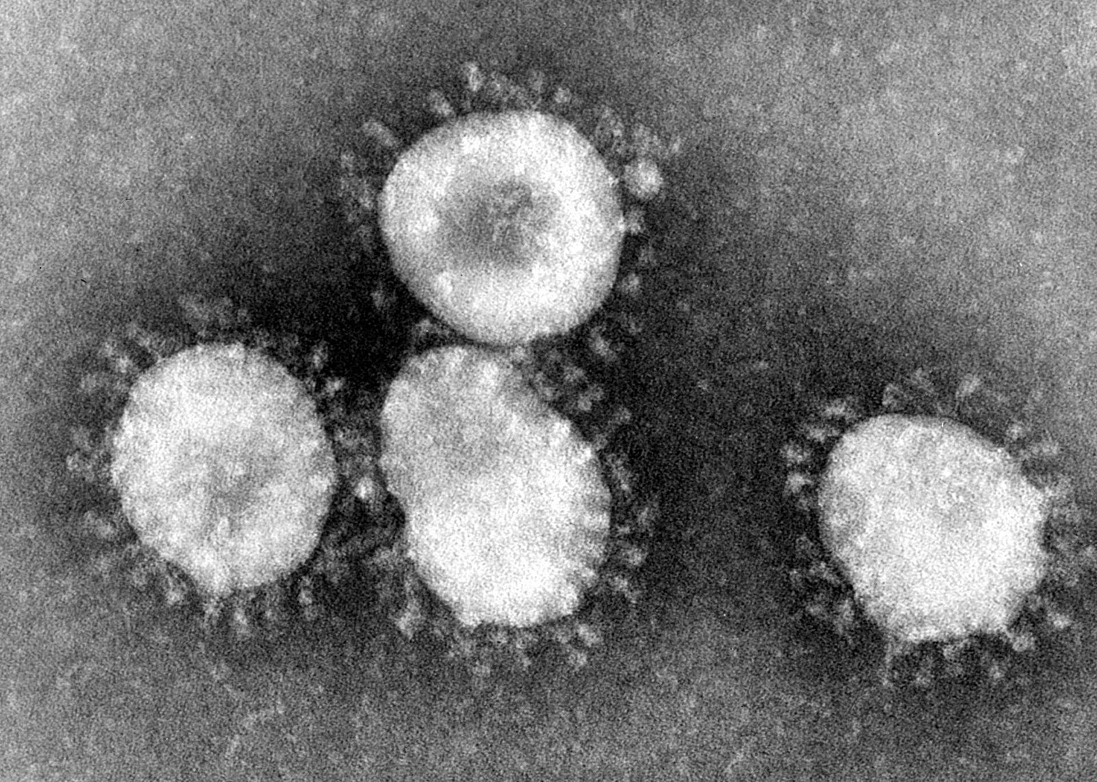 1583271347778-1600px-Coronaviruses_004_lores