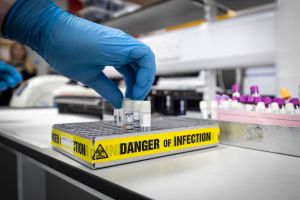 A clinical support technician extracts viruses from swab samples so that the genetic structure of a virus can be analyzed and identified in the coronavirus testing laboratory at Glasgow Royal Infirmary, on February 19, 2020 in Glasgow, Scotland. (Photo by