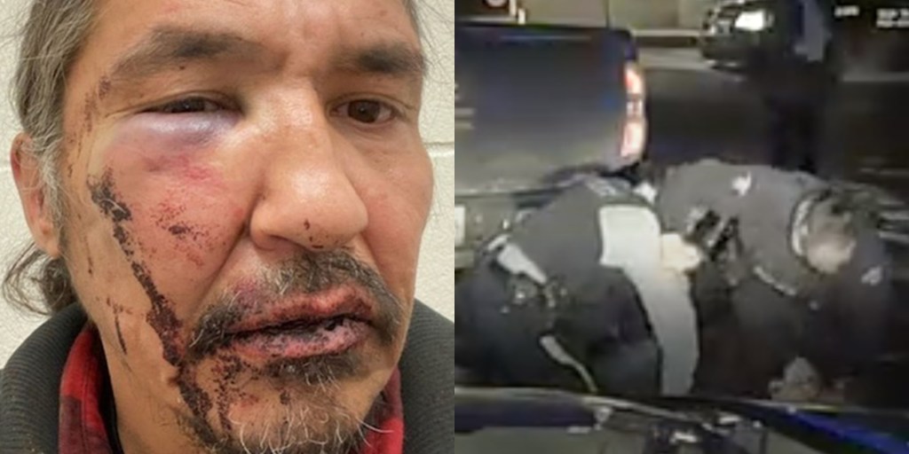 Injured Chief Allan Adam; dashcam video of RCMP punching chief