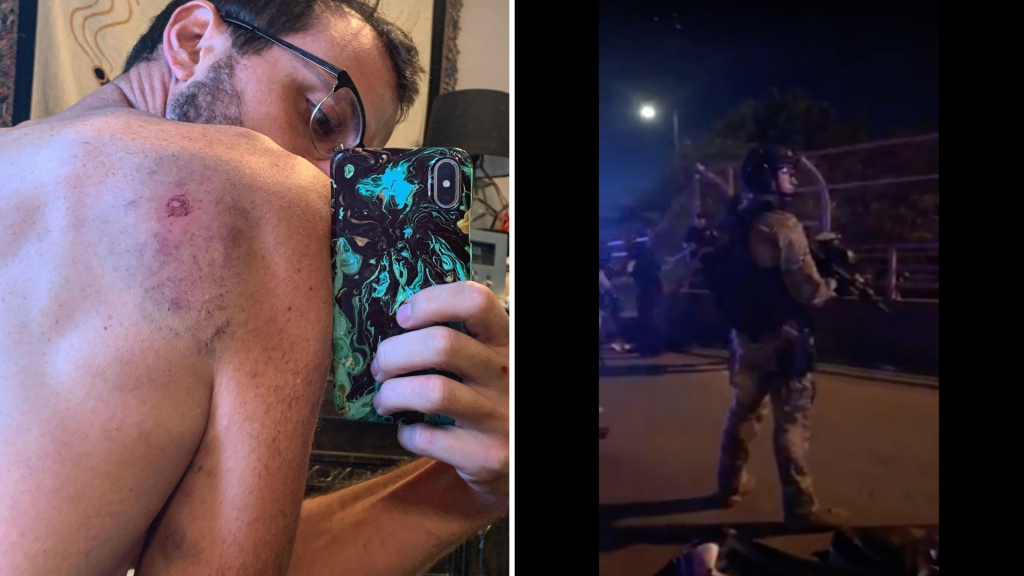 Left: Cole Christensen takes a selfie of his welts from pepper balls after the anti-racism protest in Omaha, Nebraska, on Saturday, July 25, 2020. (Photo courtesy of Cole Christensen.) Right: Screenshot of Facebook Live video of protest taken by ProBLAC.