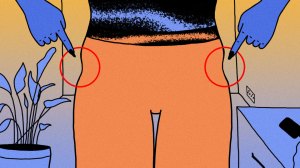 Women want to remove their "hip dips", the area where your hip and thigh bones meet, for a curvier shape.