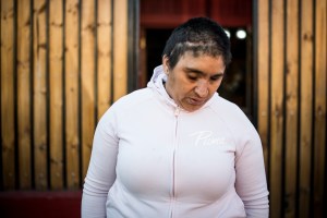 Fabiola Campillai at home in Santiago, Chile on Oct. 25,, 2020. Police shot a tear-gas canister at her face, leaving her blinded and without the ability to smell or taste​.