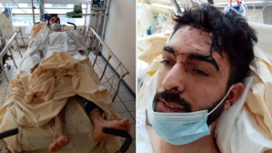 ‘They Tried to Cut Out My Tongue’: Blogger Survives Brutal Street Attack