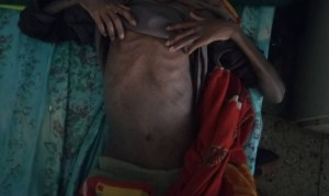 Ethiopia Denies There’s a Famine in Tigray. We Obtained Photos Of Starving Children