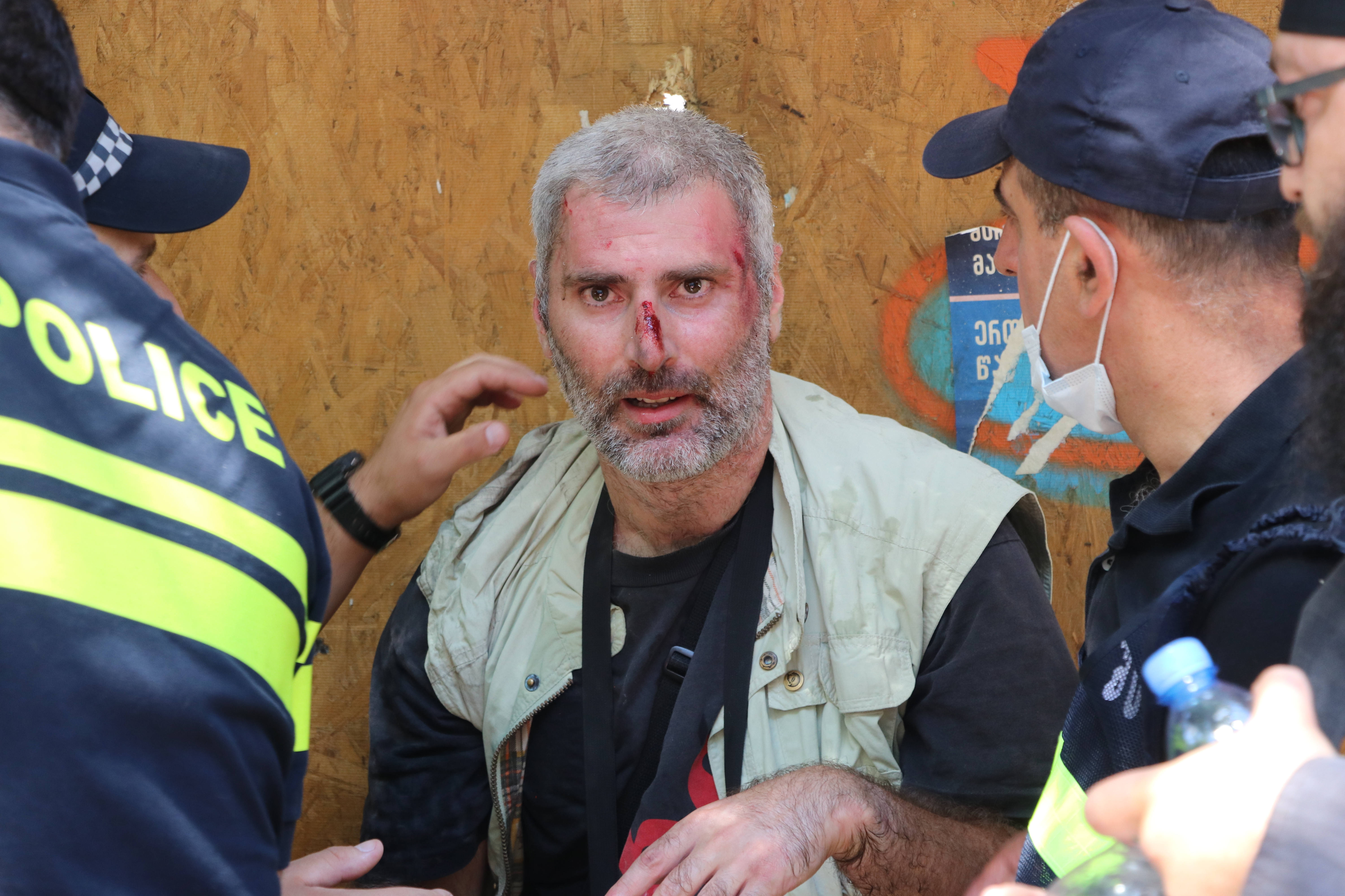 An injured journalist is seen after being attacked by anti-LGBTQ protesters. Photo: Davit Kachkachishvili/Anadolu Agency via Getty Images