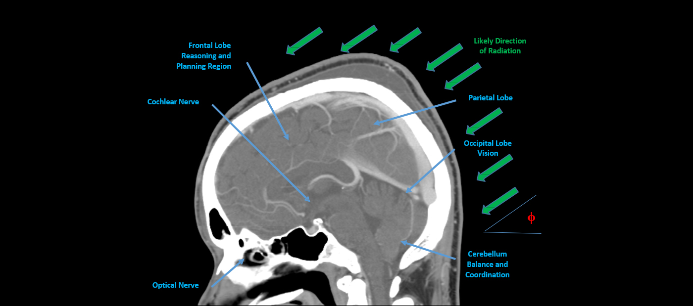 6 - Brain Damage.jpg