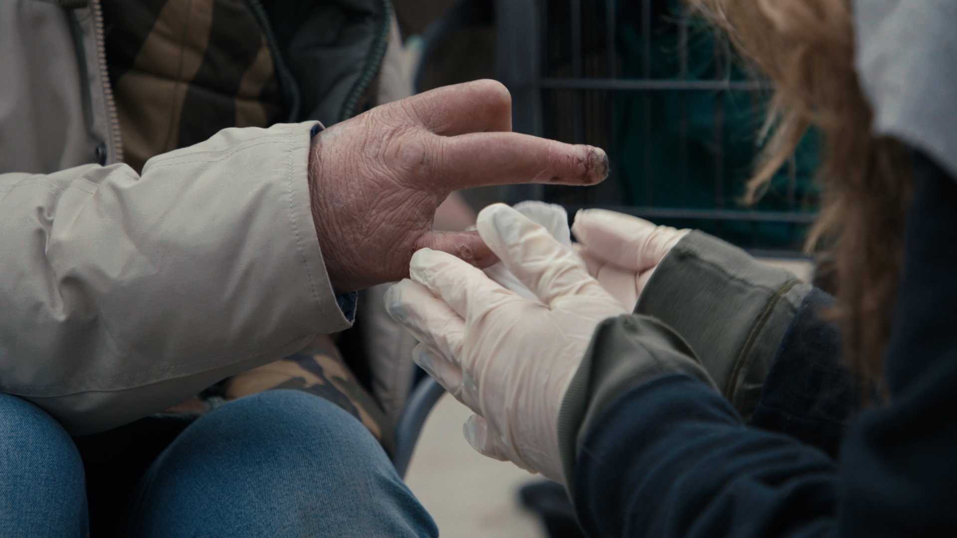 A nurse helps treat a man's wounds in Philly.