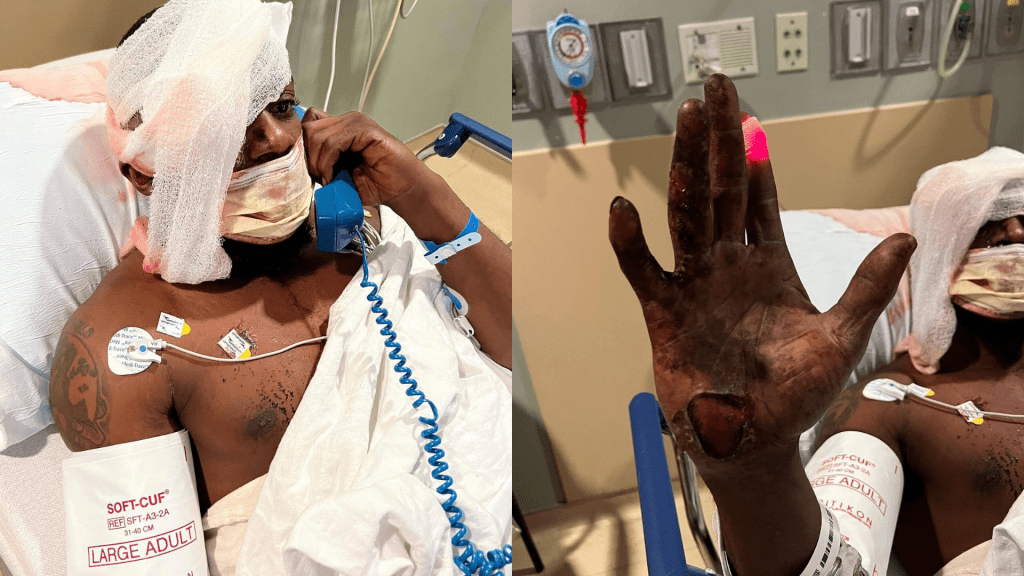 ​Terrel Bradley recovering in the hospital after being attacked by a K-9 with the Gainesville Police Department. (Image courtesy of  Danielle Chanzes)