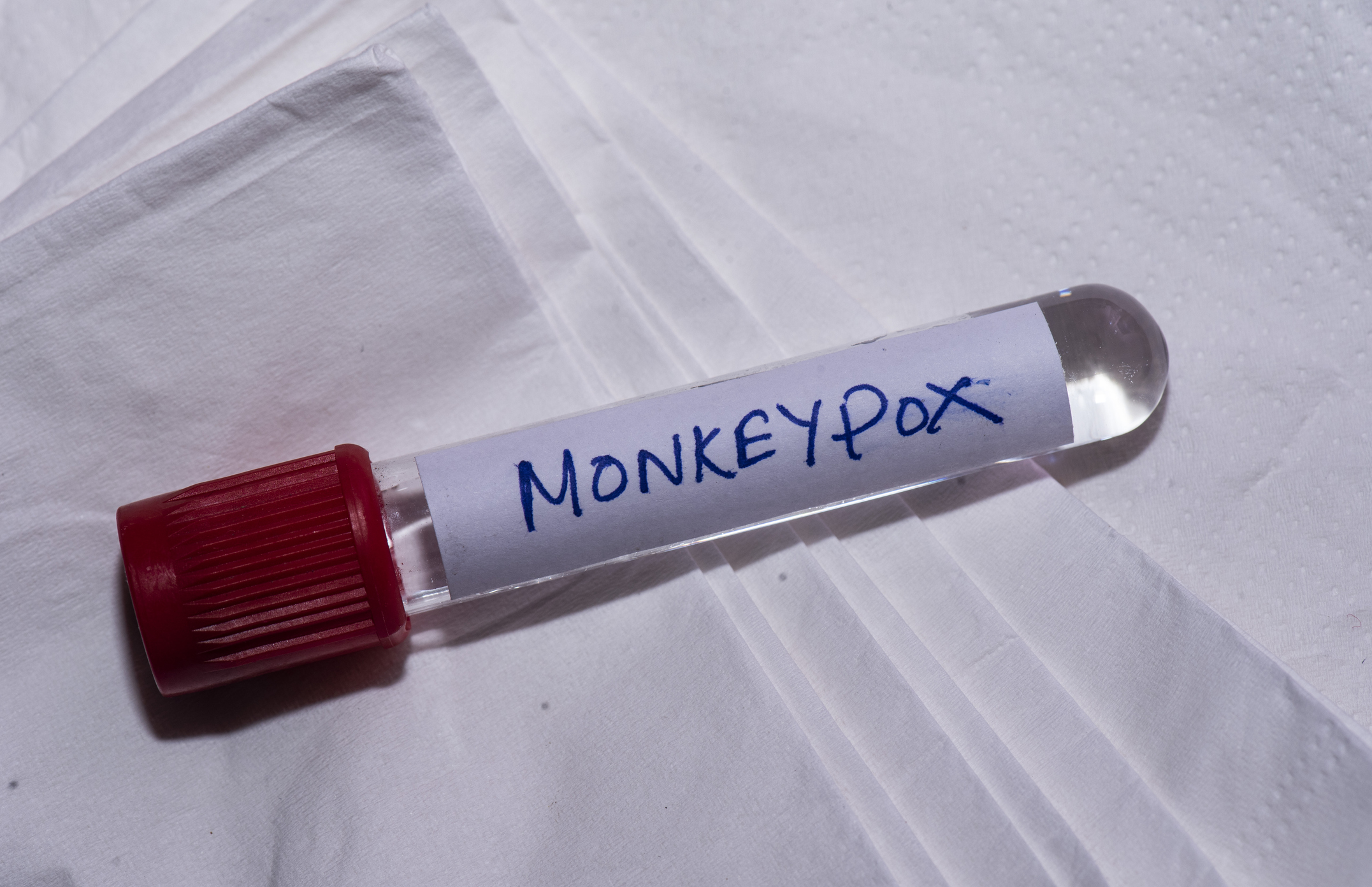 Leaked Videos of Gay Sex Lead to Calls For Monkeypox Contact  