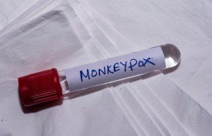 monkeypox, contact tracing, Maldives, gay sex