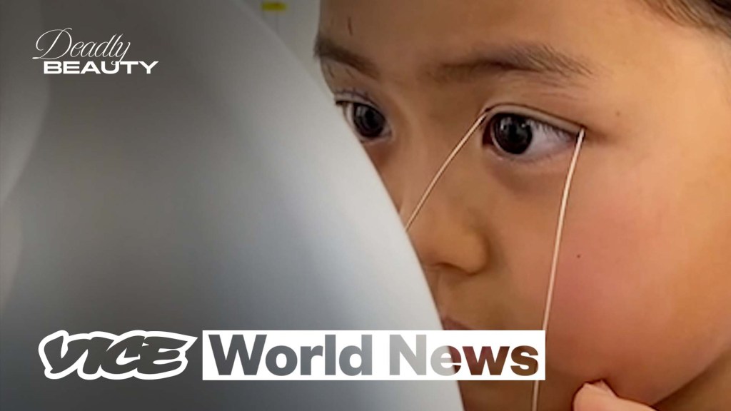 Micchi, 9, is among a growing number of children getting cosmetic surgery in Japan 整形