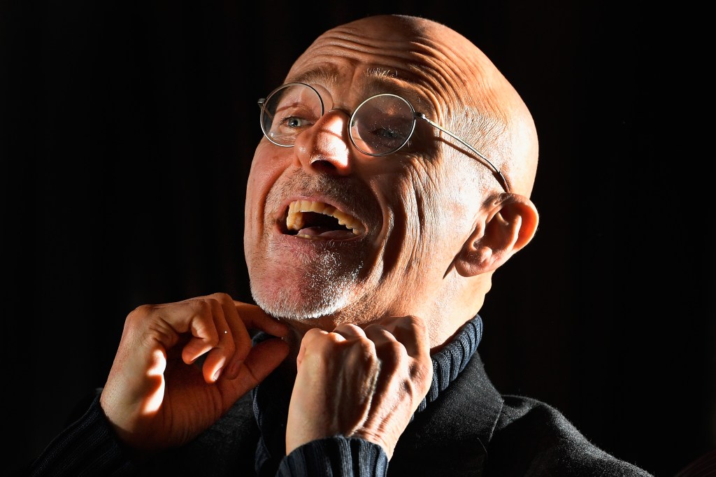 Head Transplant Surgeon Claims Human Brain Transplants Are 'Technically Feasible'