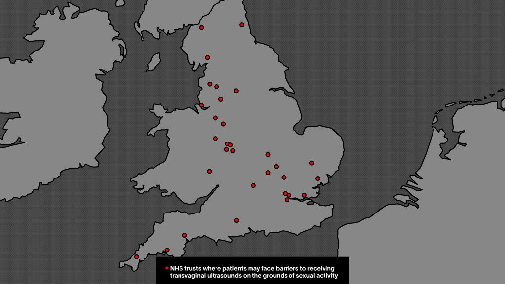 transvaginal ultrasound map england