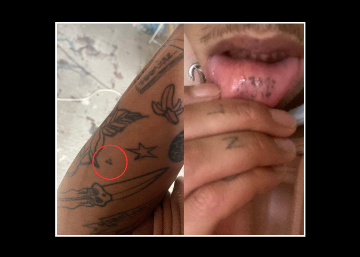 ACAB tattoos – left: three dots arranged in a triangle on someone's forearm. Right: inner lip tattoo reading 1312