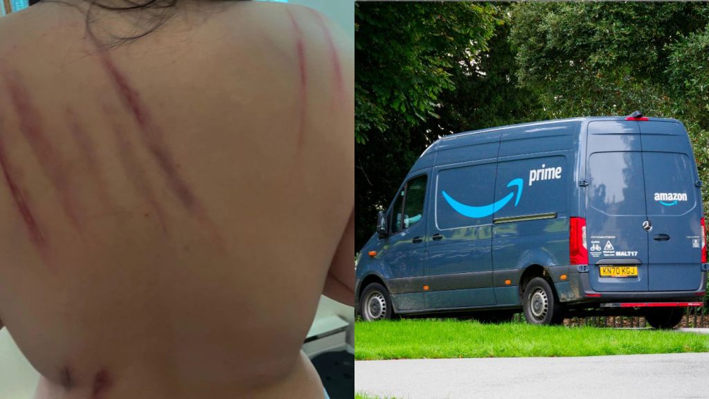 ‘We Can't Defend Ourselves’: Amazon Isn’t Doing Enough About Its Dog Bite Problem, Drivers Say