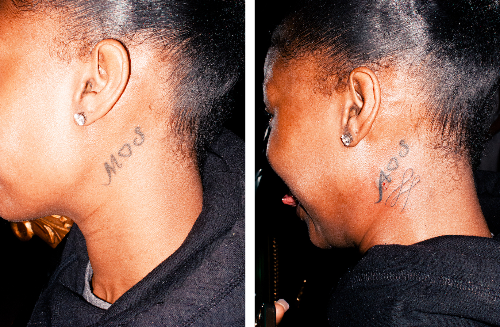 Collage of two photos. Left: A woman's head is shown to one side to reveal a tattoo on her neck. Right: Same angle of the same woman, but her tattoo has been adjusted.