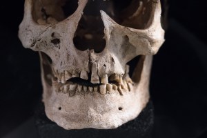 turns-out-vikings-had-really-bad-teeth